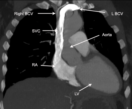 Image | Radiopaedia.org