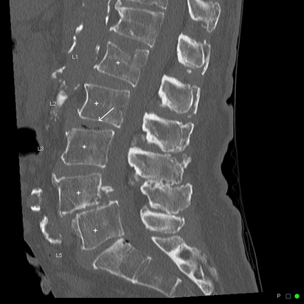 Viewing playlist: VGHTC10501 | Radiopaedia.org