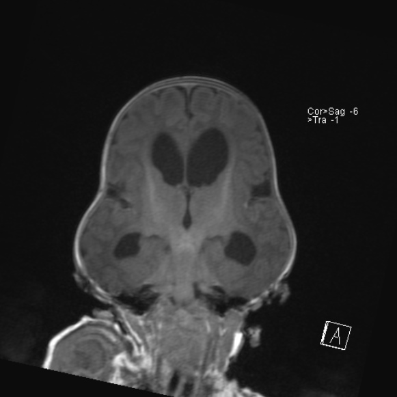 Radiology Quiz 40427 | Radiopaedia.org