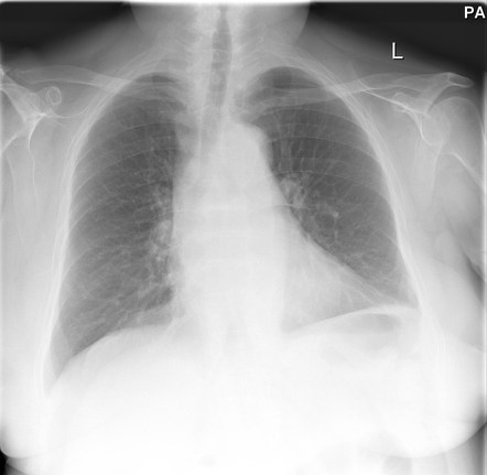 Viewing playlist: MSK - Trauma - Shoulder and Humerus | Radiopaedia.org