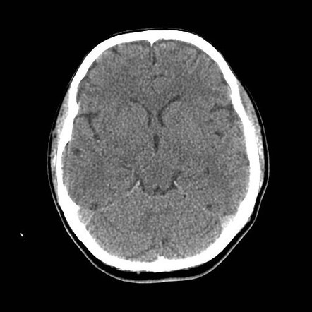 Radiology Quiz 40619 | Radiopaedia.org