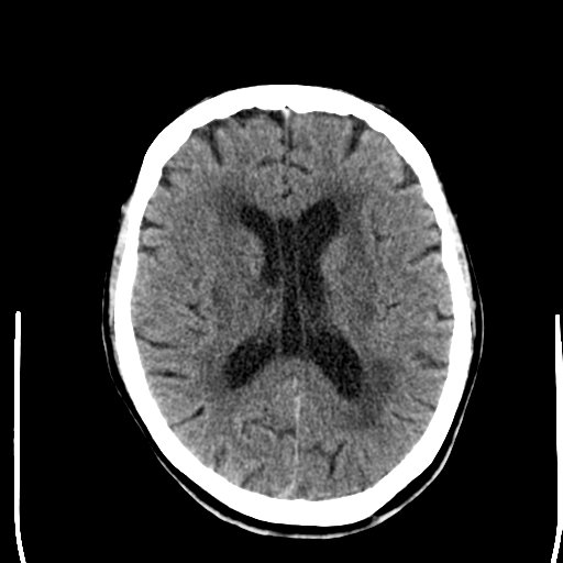 image-radiopaedia