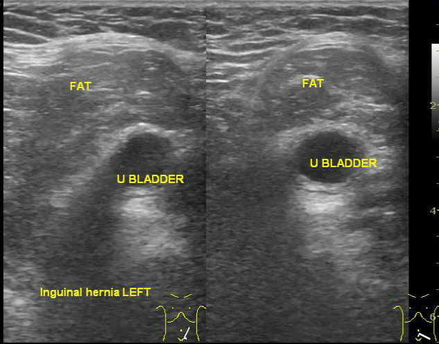 Image | Radiopaedia.org