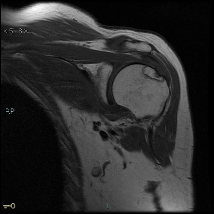 Playlist 'Wildcats Shoulder MRI' by Dr Hao Xiang