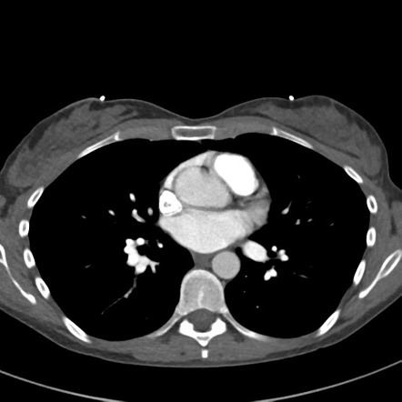 Playlist 'high Yield Ct' By Dr. Nicholas Mckay Parry