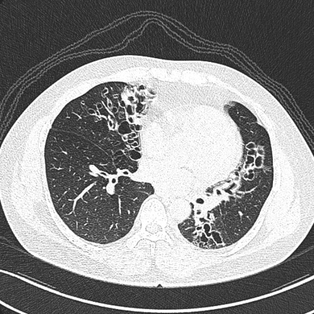 Radiology Quiz 40909 | Radiopaedia.org