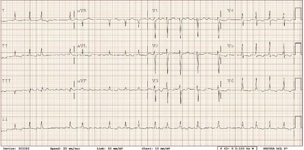 Image | Radiopaedia.org