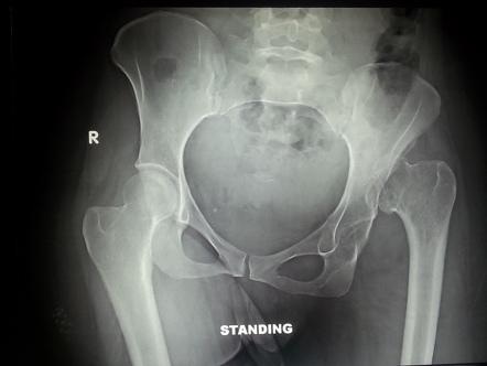 Radiology Quiz 41067 | Radiopaedia.org