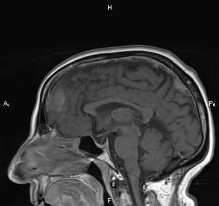 Viewing playlist: Locations of Swan Ganz catheters | Radiopaedia.org