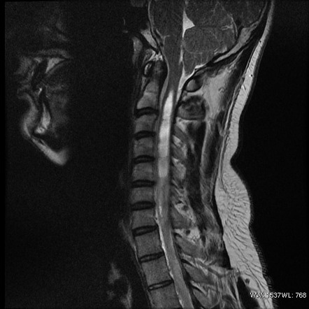 Playlist 'Neuroradiology' by Ali