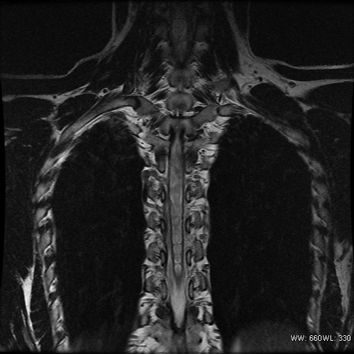 Image | Radiopaedia.org