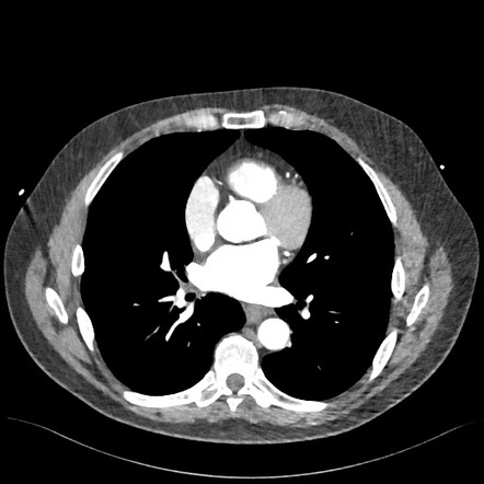 Playlist 'Anatomy' by dr sameh saad