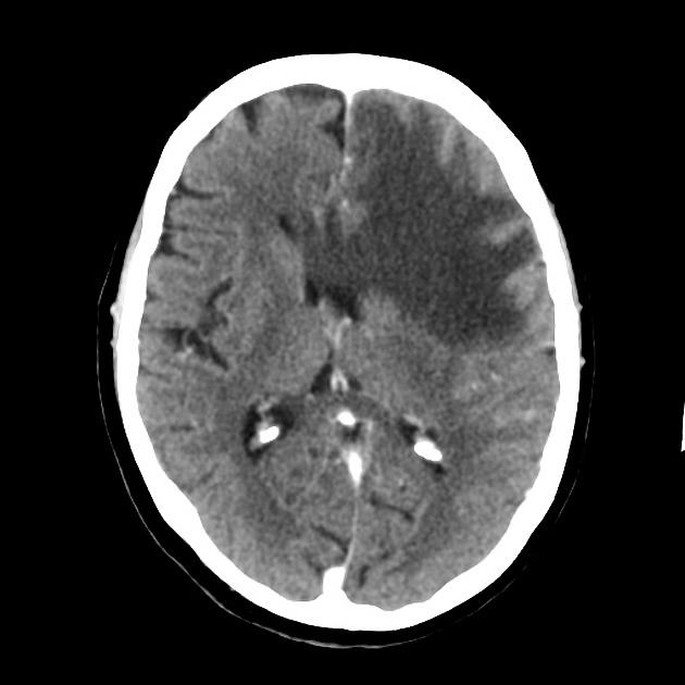 Radiology Quiz 41814 | Radiopaedia.org