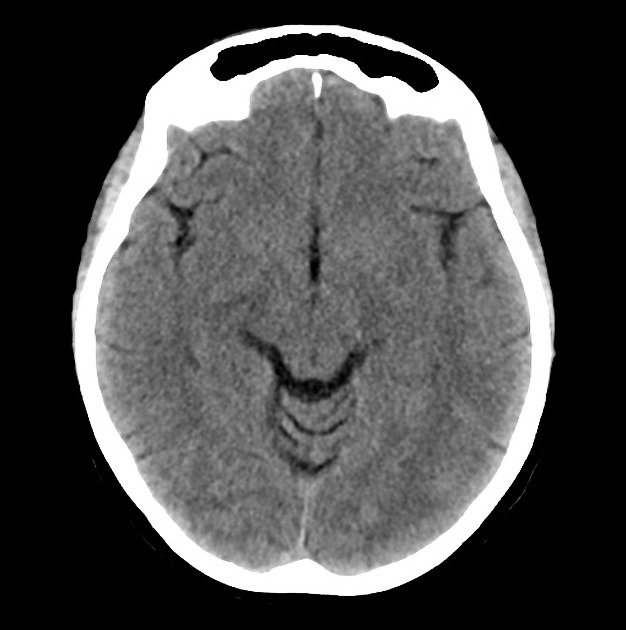 Radiology Quiz 41870 | Radiopaedia.org