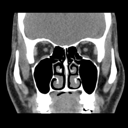 Viewing playlist: Normal | Radiopaedia.org