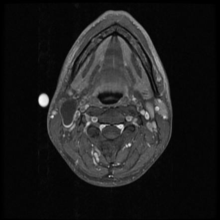 Playlist 'Reham salivary gland' by Reham Mohamed