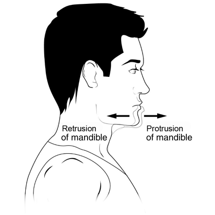 Anatomical position | Radiology Reference Article | Radiopaedia.org