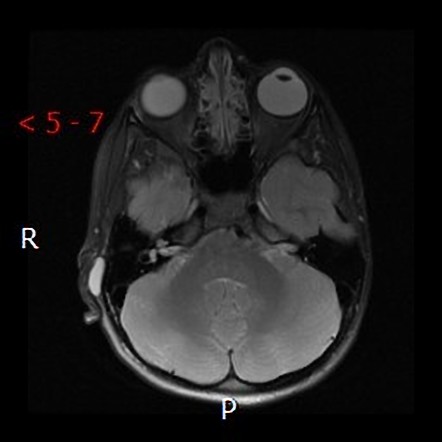 Image | Radiopaedia.org