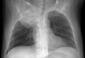 Radiology Quiz 17628 | Radiopaedia.org