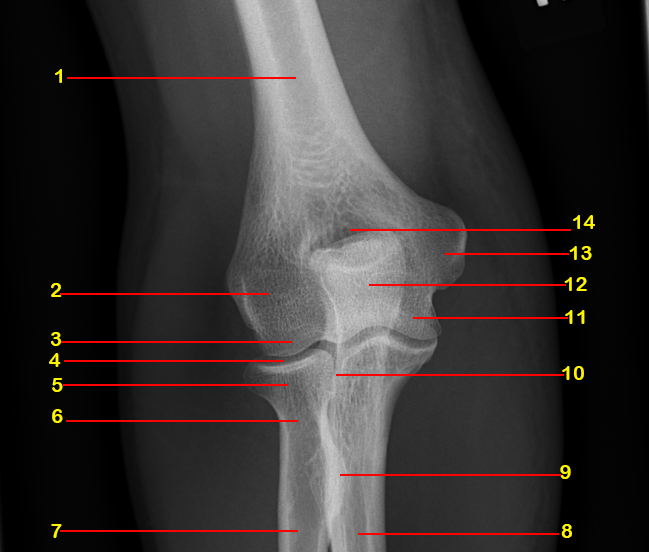 Image Radiopaedia Org