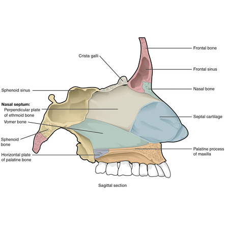 Facial bones | Radiology Reference Article | Radiopaedia.org