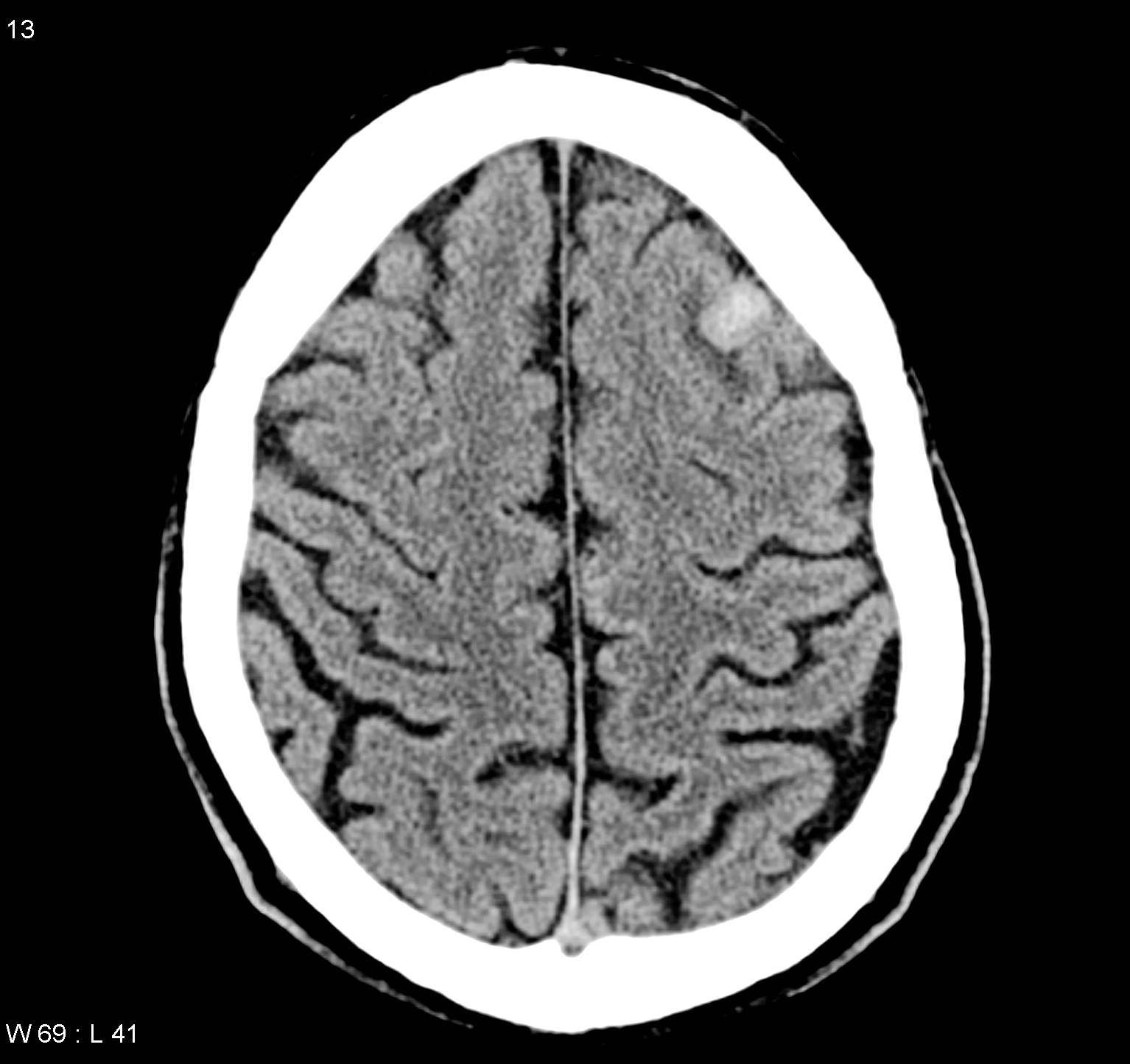 image-radiopaedia