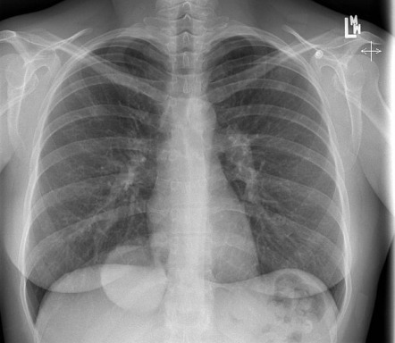 Radiology Quiz 17754 | Radiopaedia.org