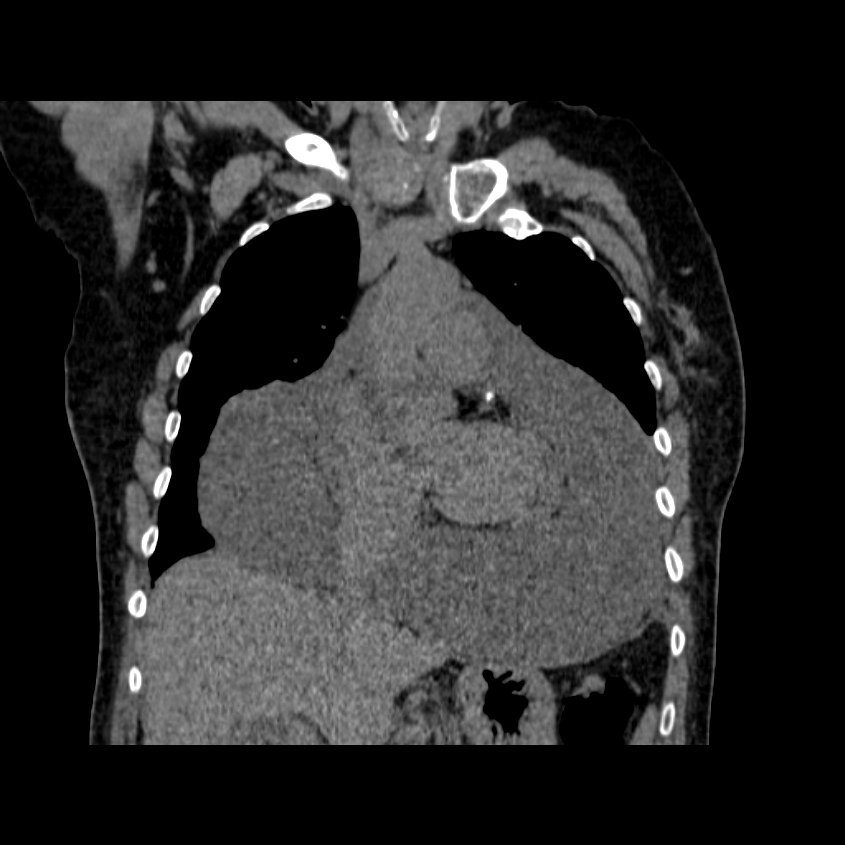 Image Radiopaedia Org