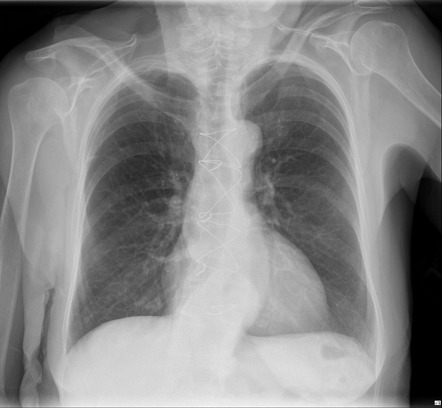 Final FRCR Part B rapid reporting | Radiology Reference Article ...