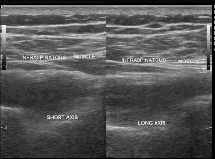 Image | Radiopaedia.org