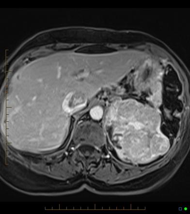 Renal Dynamic Imaging