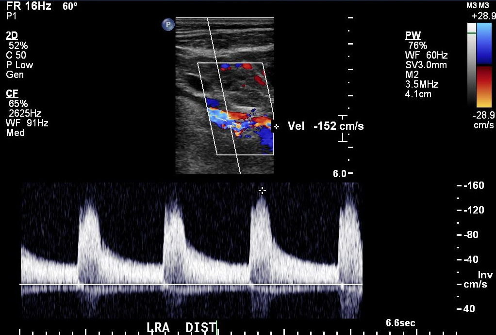 Image | Radiopaedia.org