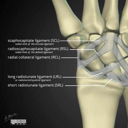 Scaphocapitate ligament | Radiology Reference Article | Radiopaedia.org