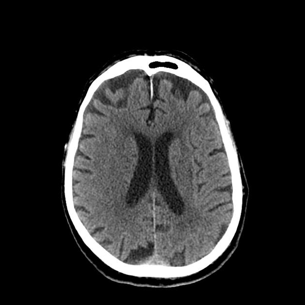 Radiology Quiz 18368 | Radiopaedia.org