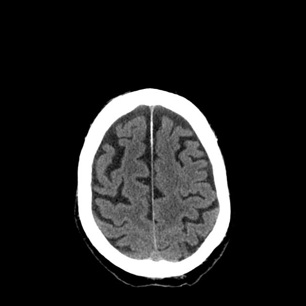 Radiology Quiz 18368 | Radiopaedia.org