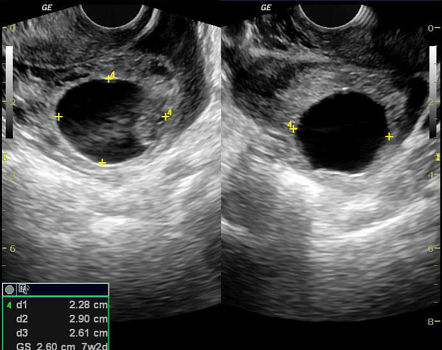 Image | Radiopaedia.org