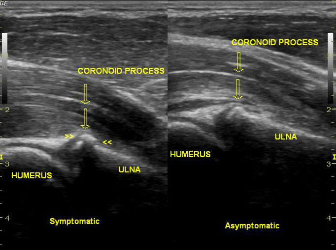 Image | Radiopaedia.org