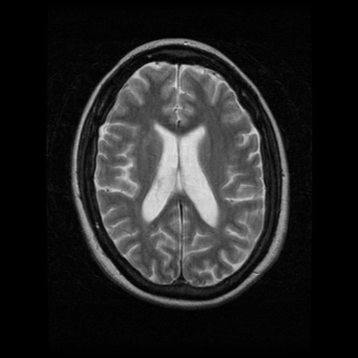 Mitochondrial G8292A and C8794T mutations in patients with Niemann‑Pick  disease type C Corrigendum in /10.3892/br.2018.1156