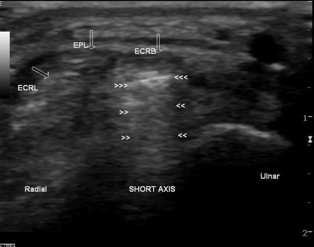  US  imaging Modes & Artefacts    E7e94bb5b131a06edd92dcfeeb199b_big_gallery