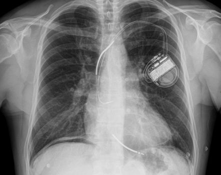 Viewing playlist: CHR 663L Lesson 9: Abdominal Imaging | Radiopaedia.org