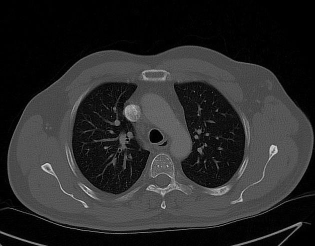 Radiology Quiz 44407 | Radiopaedia.org