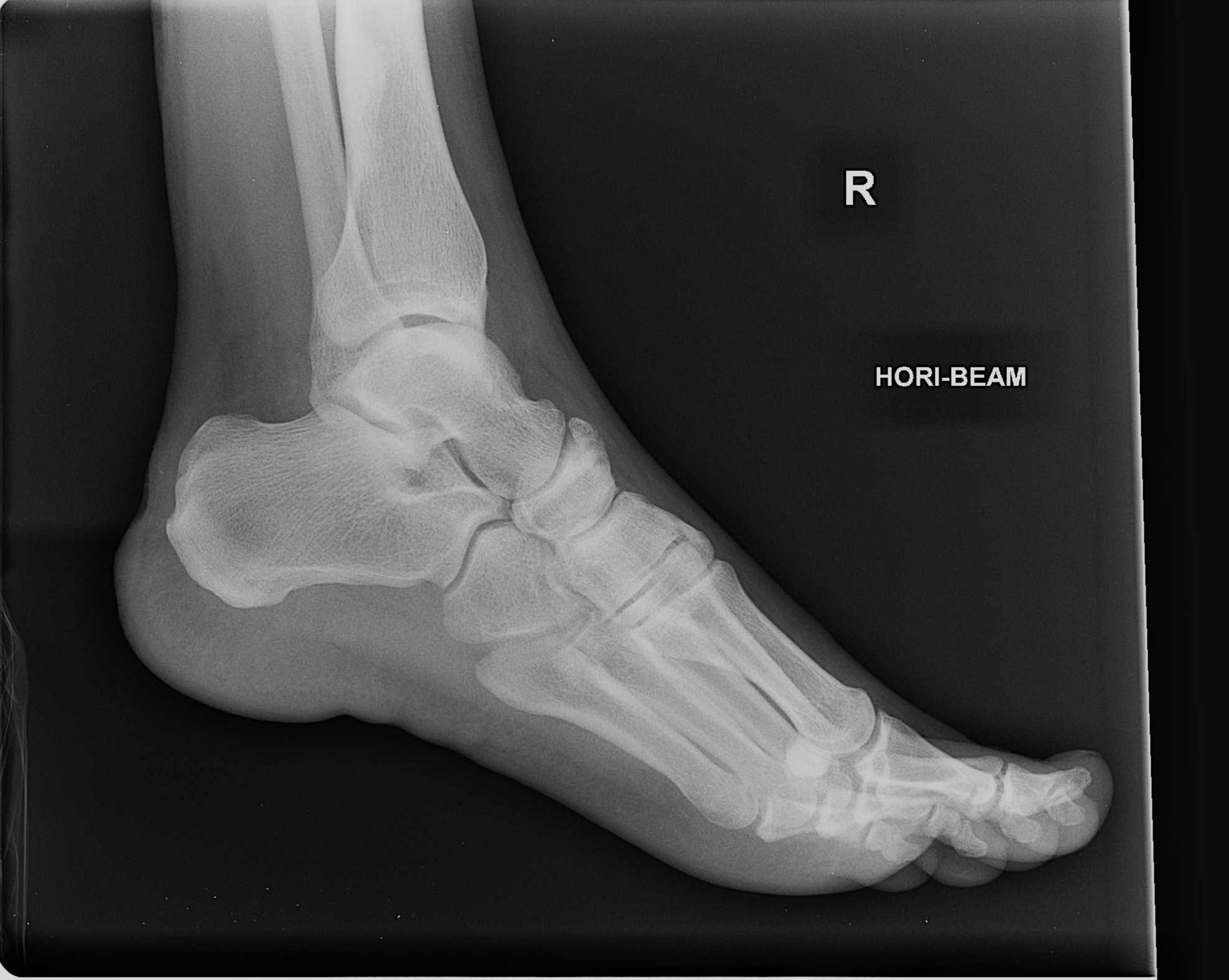 Foot Radiograph Anatomy