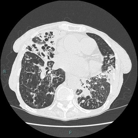 Playlist 'Chest cases' by Dr Nicholas Willmore