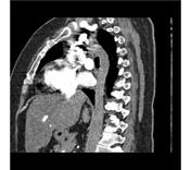 Viewing playlist: Cardiac | Radiopaedia.org