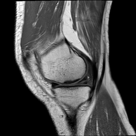 Viewing playlist: MRI knee | Radiopaedia.org