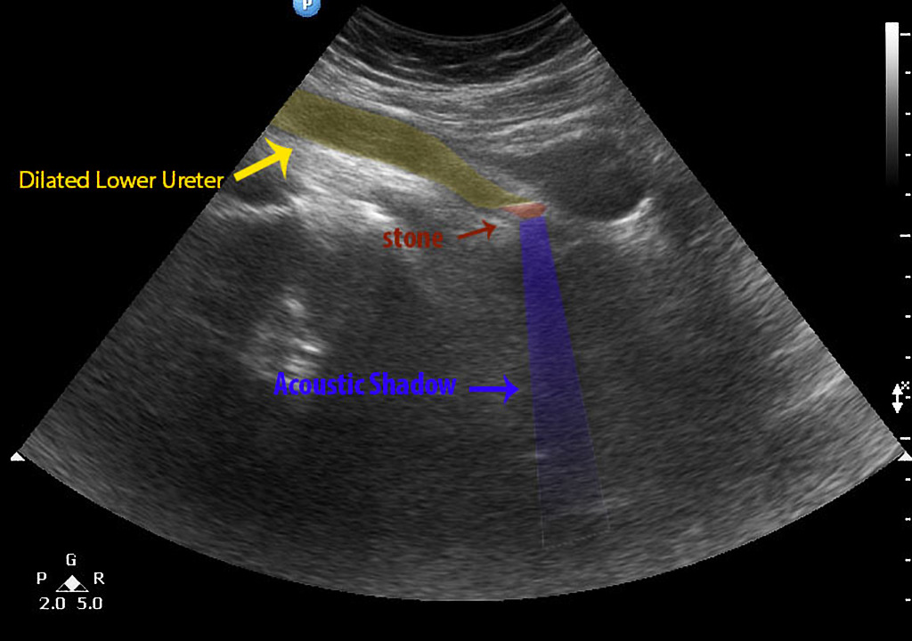 Image | Radiopaedia.org