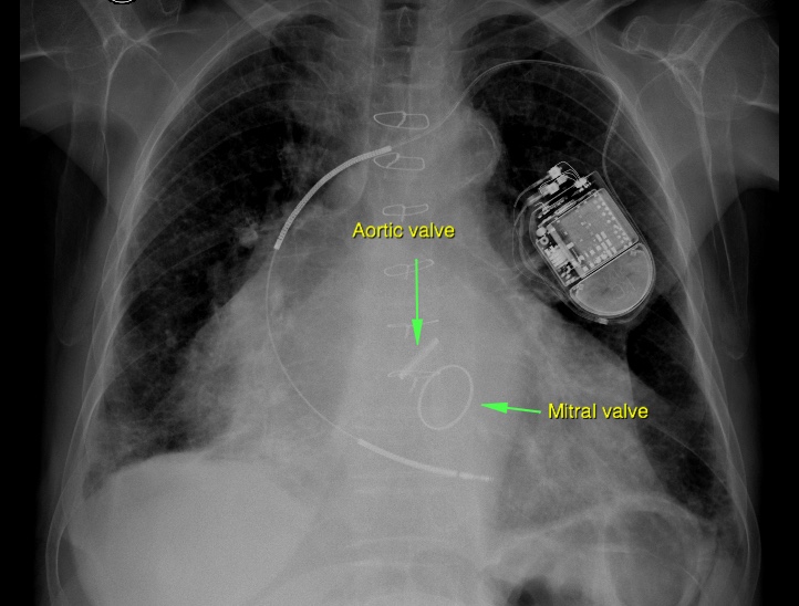 Image Radiopaedia Org