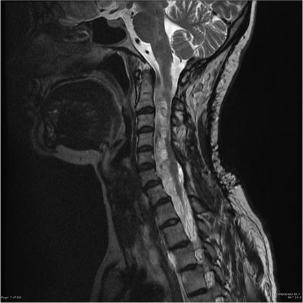 Playlist 'GD: Paediatrics - CNS - Phakomatoses' by Dr Gurjeet Dulku