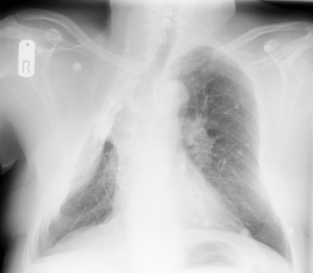 Radiology Quiz 46034 | Radiopaedia.org