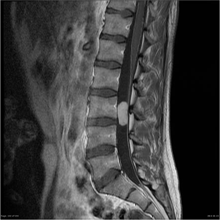 Viewing playlist: NW # 2 | Radiopaedia.org